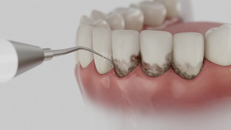 Trusted Tooth Extraction service in Twin Falls, ID - Dentist Open Now